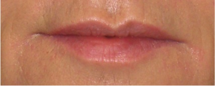 Lips After Feather Lip Smoothie